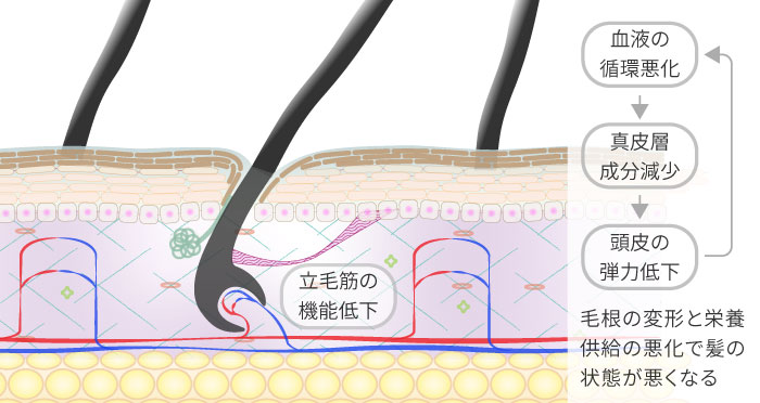 頭皮が硬くなり毛根まわりの環境が乱れた状態